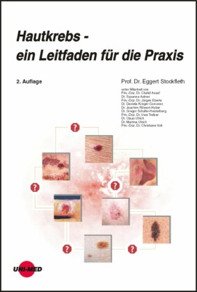 Hautkrebs - ein Leitfaden für die Praxis