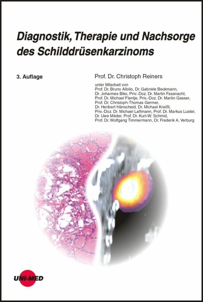 Diagnostik, Therapie und Nachsorge des Schilddrüsenkarzinoms main product photo