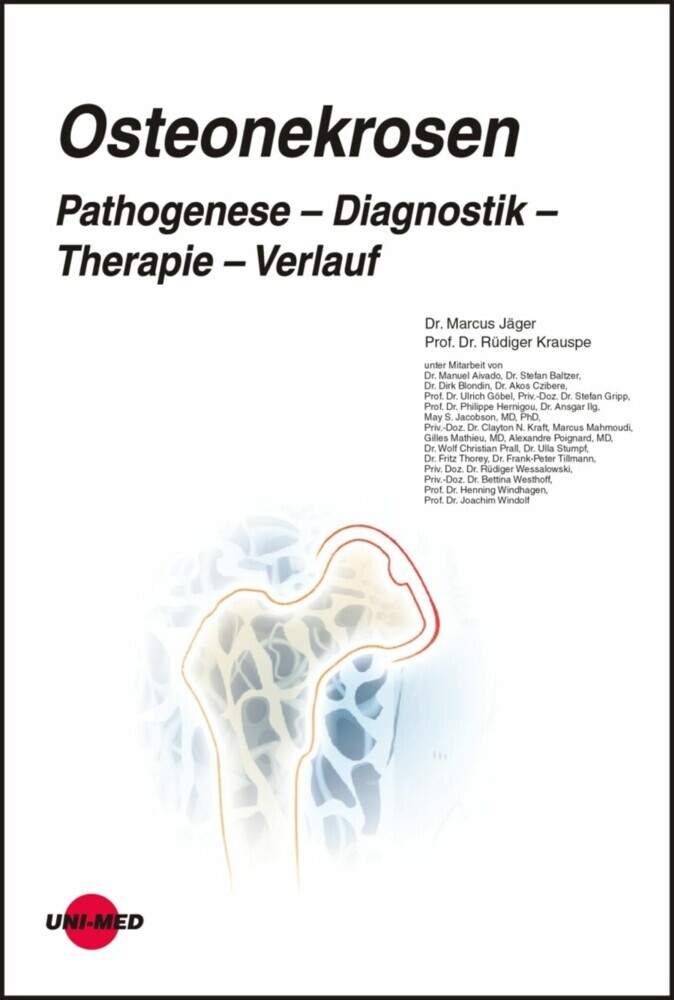Osteonekrosen. Pathogenese - Diagnostik - Therapie - Verlauf main product photo