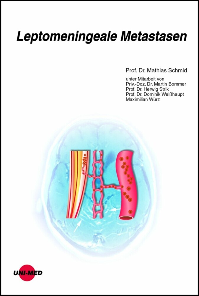 Leptomeningeale Metastasen main product photo