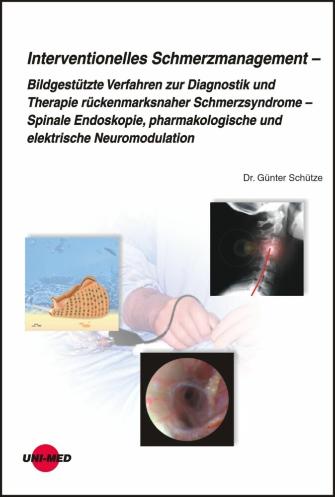 Interventionelles Schmerzmanagement main product photo