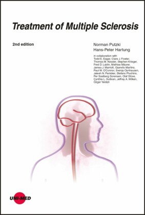 Treatment of Multiple Sclerosis