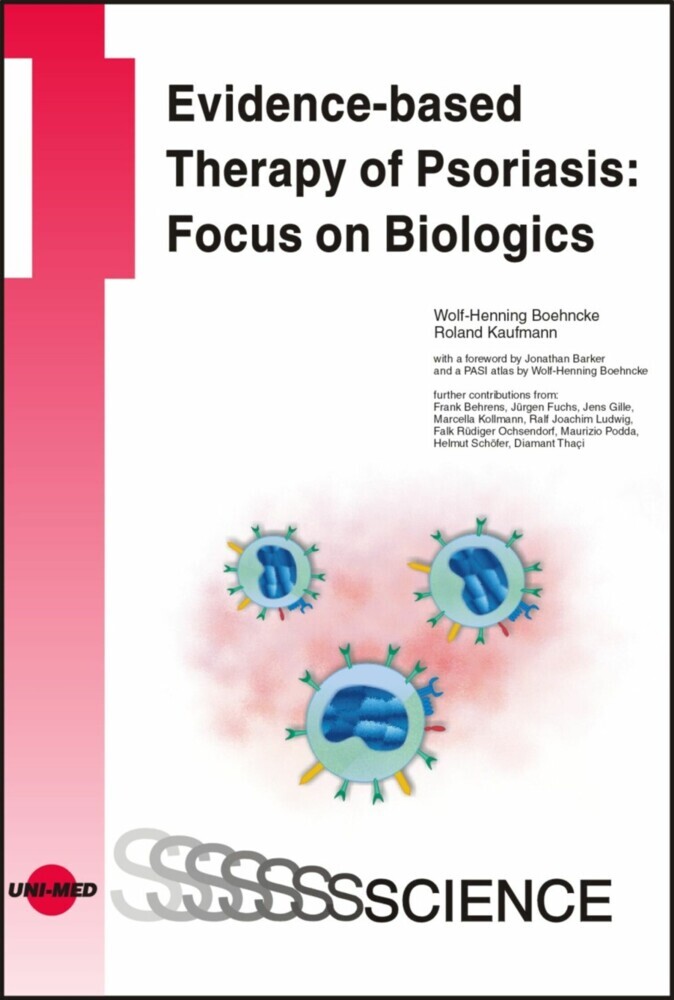 Evidence-based Therapy of Psoriasis: Focus on Biologics main product photo
