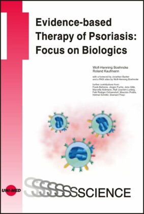 Evidence-based Therapy of Psoriasis: Focus on Biologics
