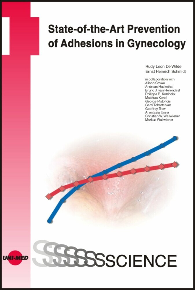 State-of-the-Art Prevention of Adhesions in Gynecology main product photo
