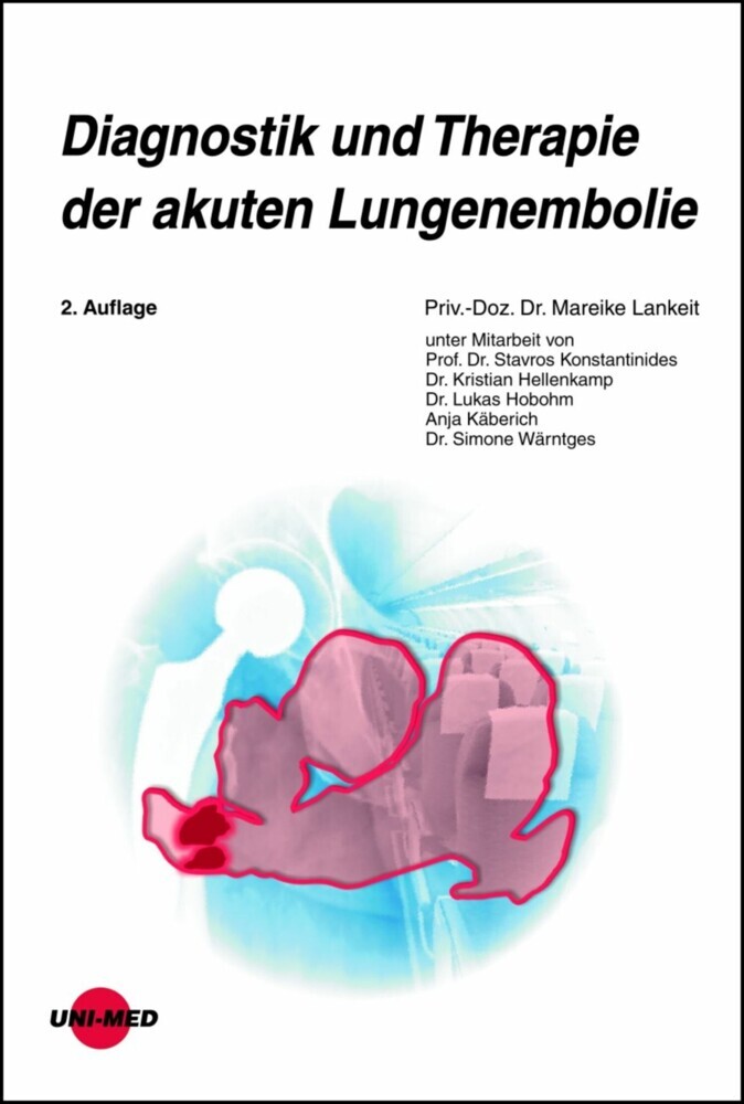 Diagnostik und Therapie der akuten Lungenembolie main product photo