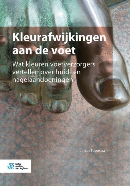 Kleurafwijkingen aan de voet main product photo