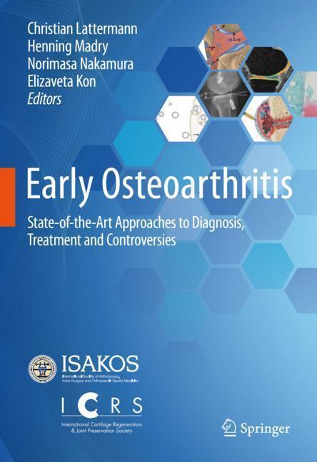 Early Osteoarthritis main product photo