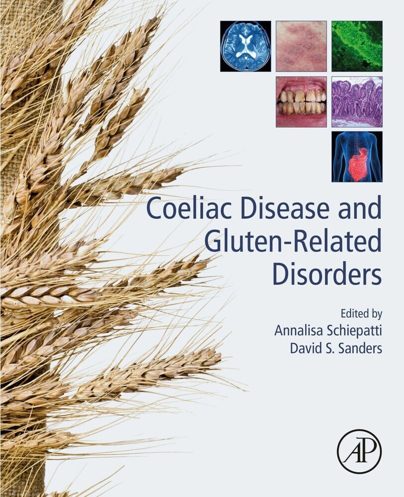 Coeliac Disease and Gluten-Related Disorders main product photo