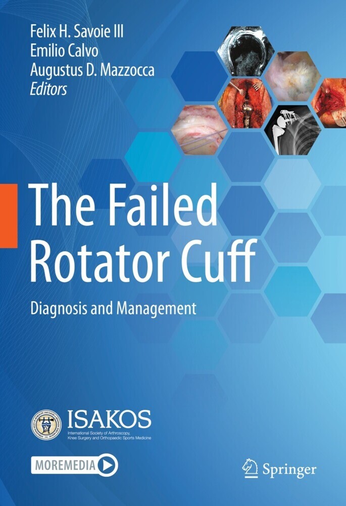 The Failed Rotator Cuff main product photo