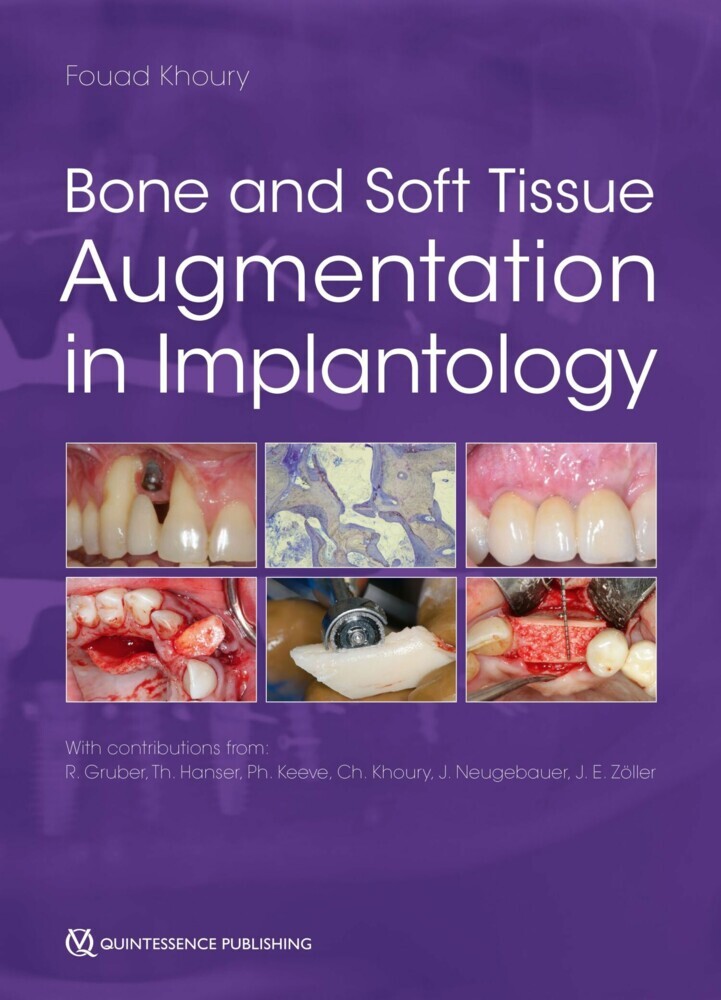 Bone and Soft Tissue Augmentation in Implantology main product photo