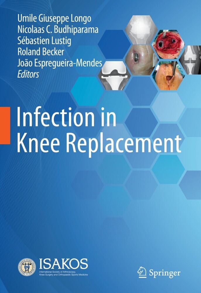 Infection in Knee Replacement main product photo