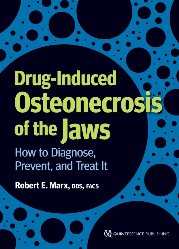 Drug-Induced Osteonecrosis of the Jaws main product photo