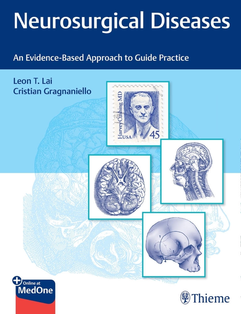 Neurosurgical Diseases main product photo