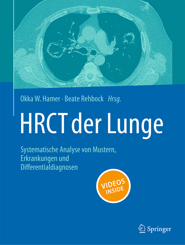 HRCT der Lunge main product photo