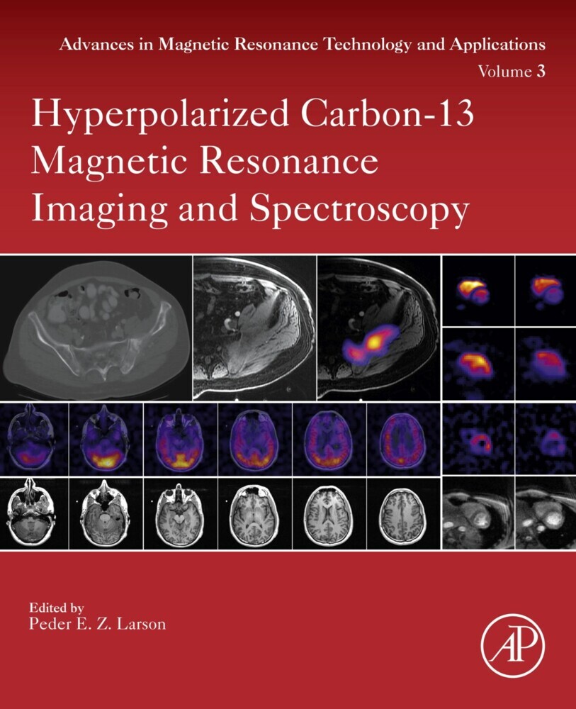 Hyperpolarized Carbon-13 Magnetic Resonance Imaging and Spectroscopy main product photo