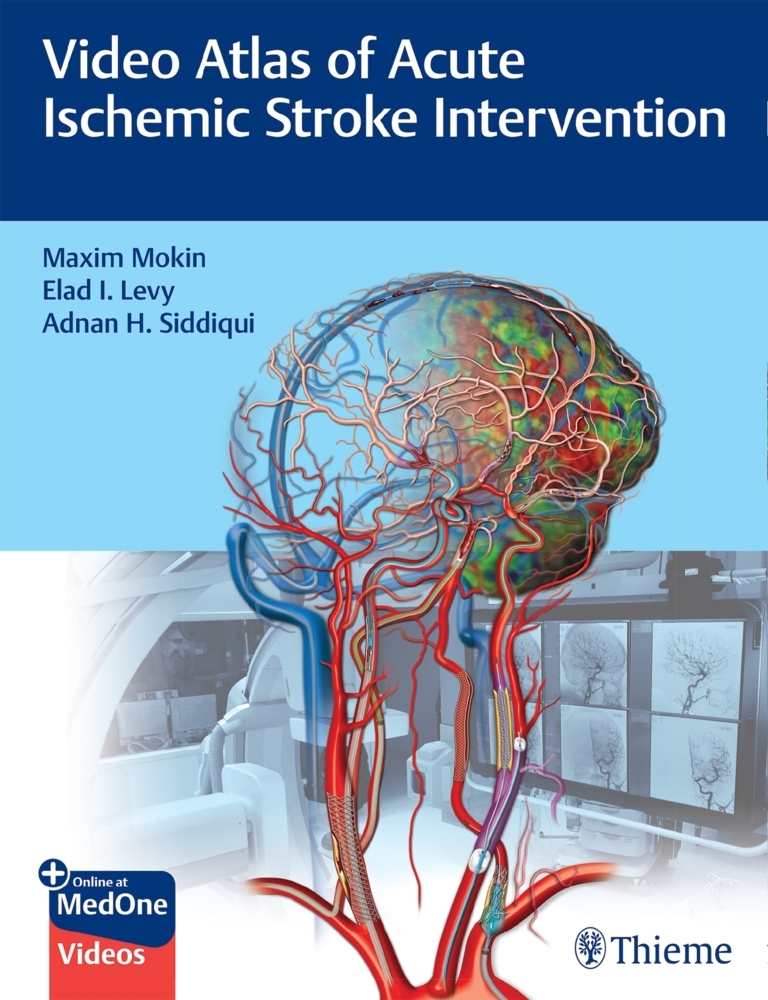 Video Atlas of Acute Ischemic Stroke Intervention main product photo