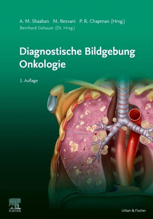 Diagnostische Bildgebung Onkologie main product photo