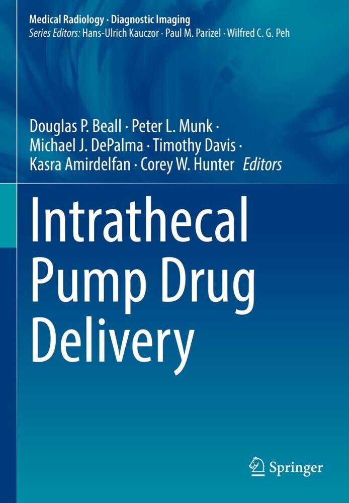 Intrathecal Pump Drug Delivery main product photo