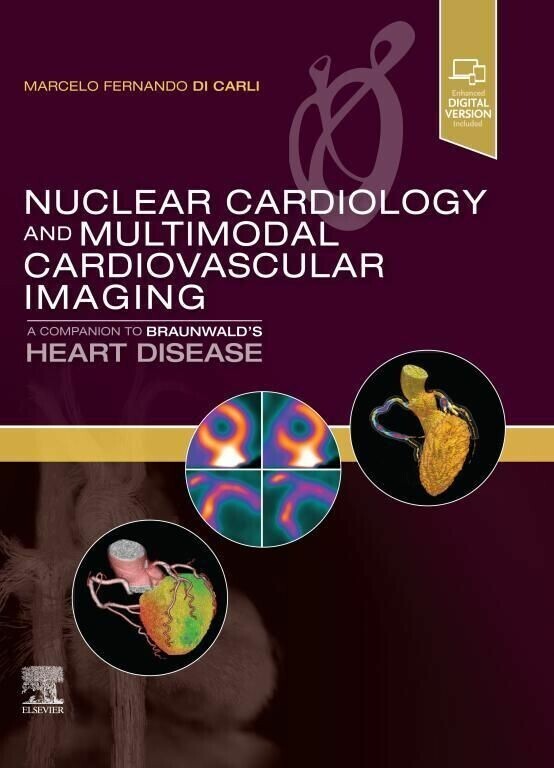 Nuclear Cardiology and Multimodal Cardiovascular Imaging, E-Book main product photo
