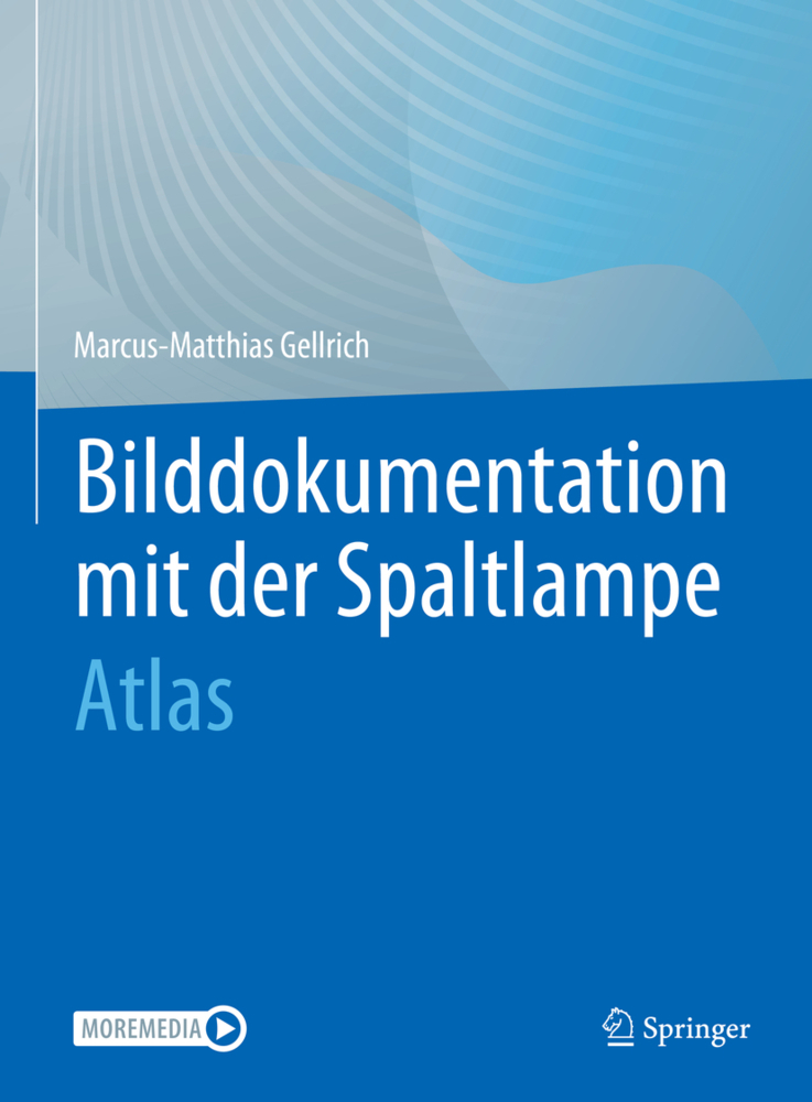 Bilddokumentation mit der Spaltlampe main product photo