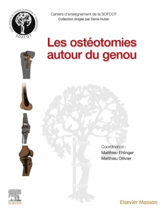 Les ostéotomies autour du genou
