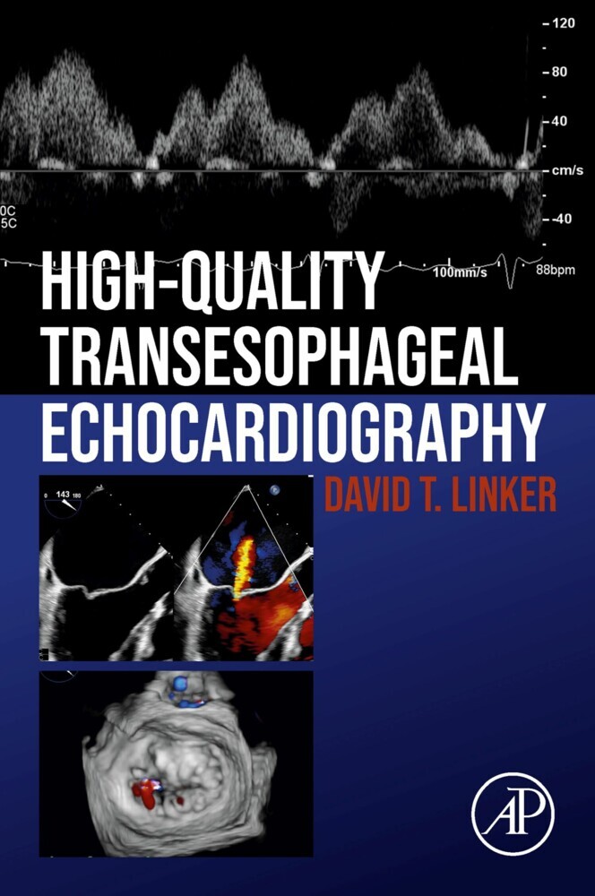 High-Quality Transesophageal Echocardiography main product photo