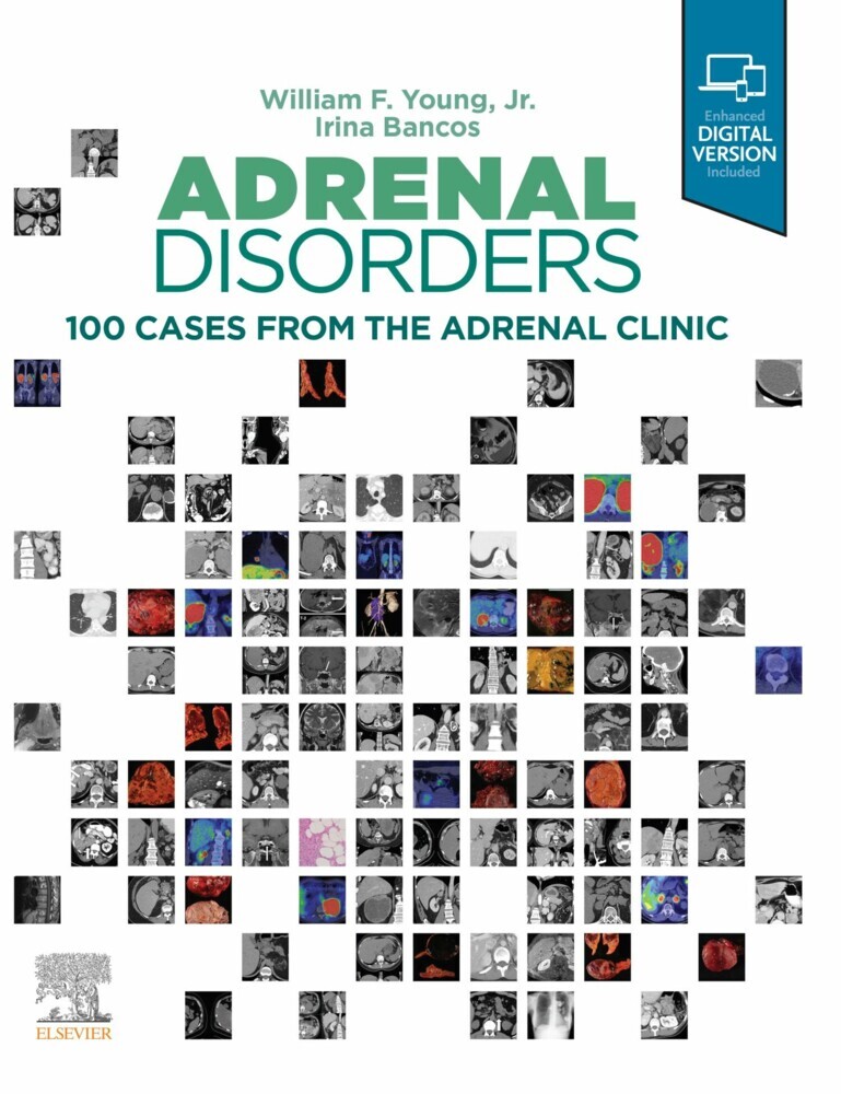 Adrenal Disorders,E-Book main product photo
