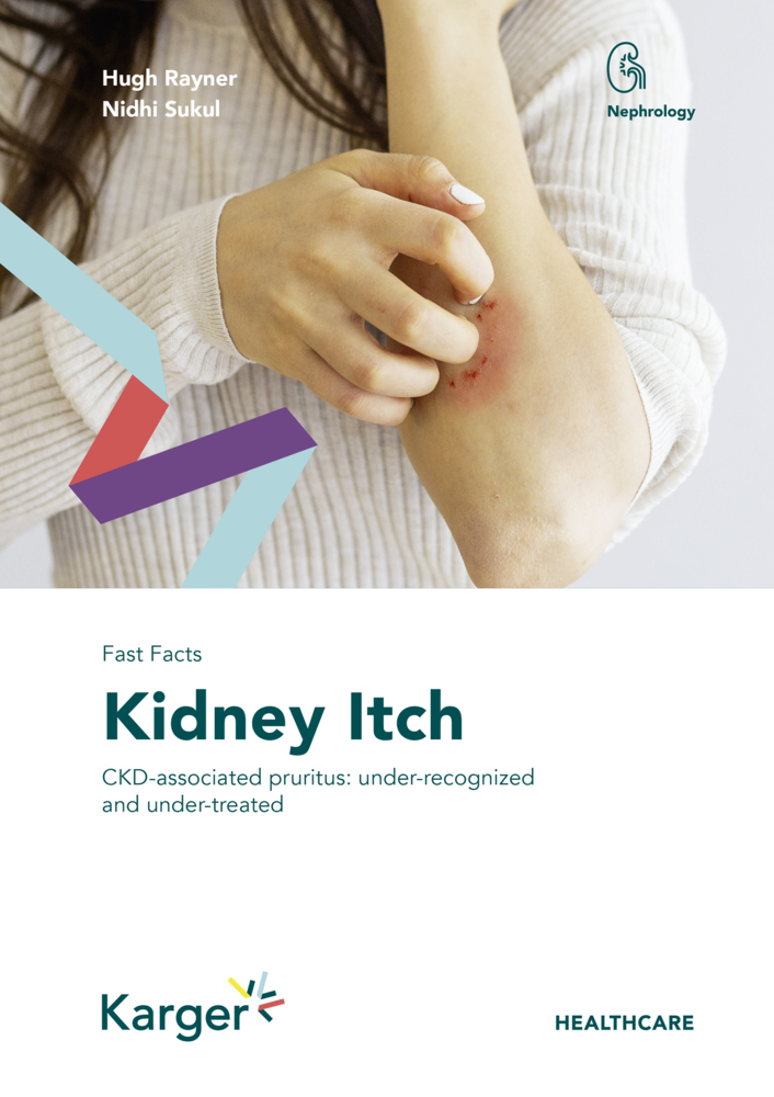 Fast Facts: Kidney Itch main product photo