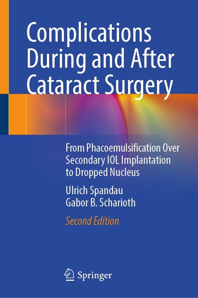Complications During and After Cataract Surgery main product photo