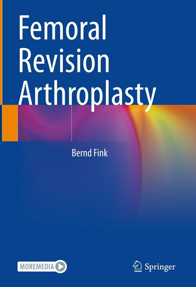 Femoral Revision Arthroplasty main product photo