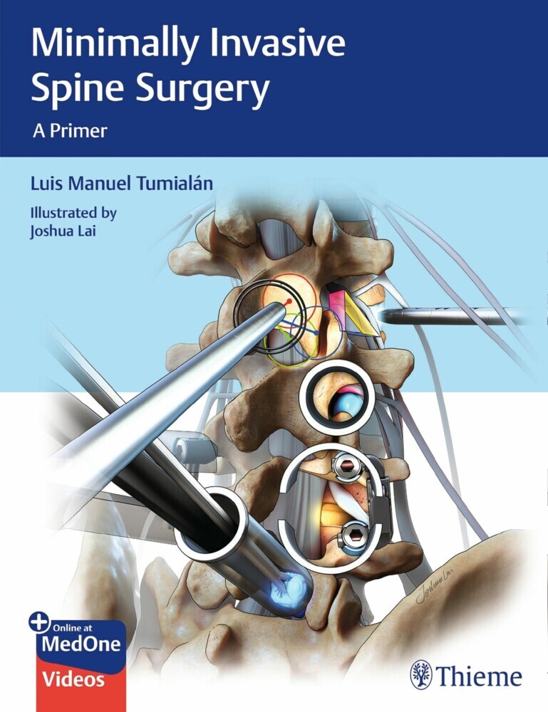 Minimally Invasive Spine Surgery main product photo