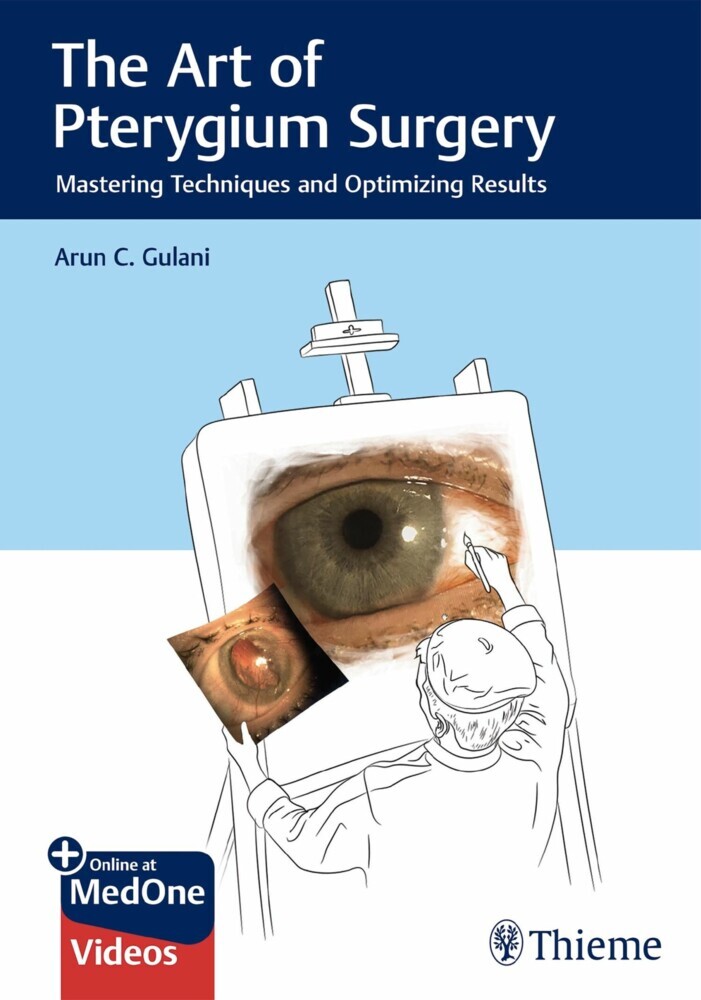 The Art of Pterygium Surgery main product photo