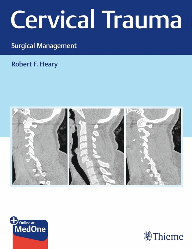 Cervical Trauma main product photo