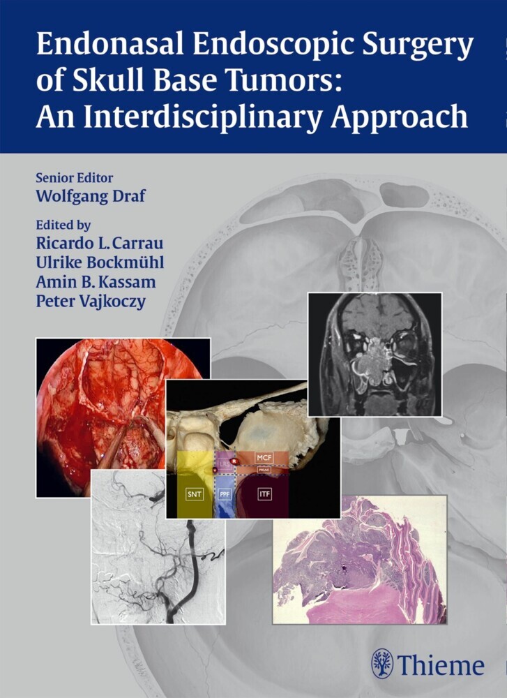 Endonasal Endoscopic Surgery of Skull Base Tumors: An Interdisciplinary Approach main product photo