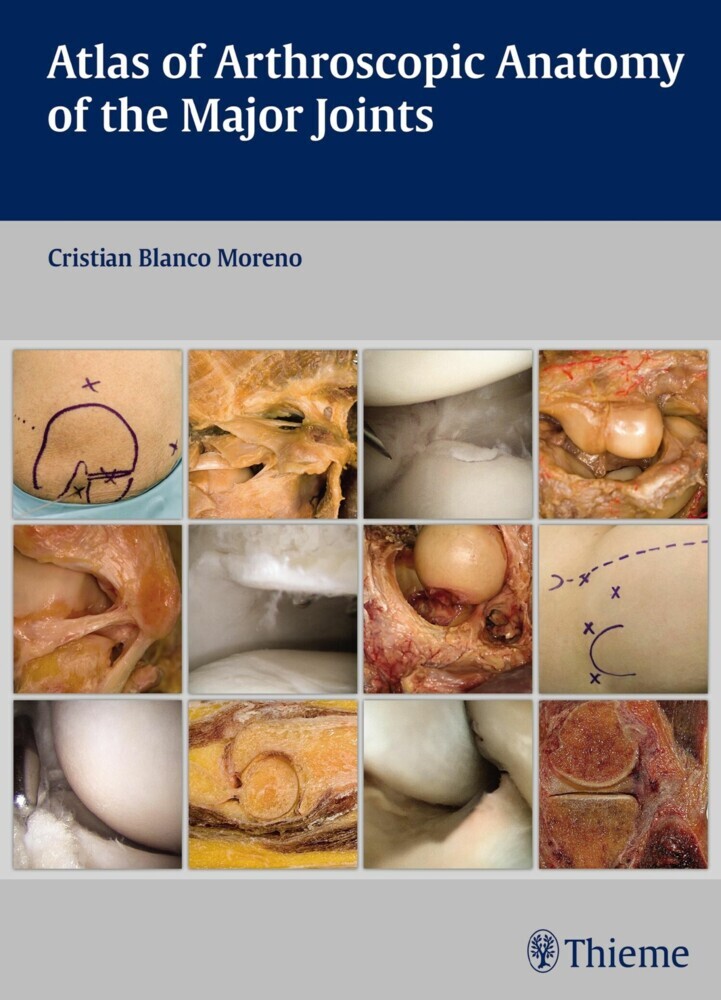 Atlas of Arthroscopic Anatomy of the Major Joints main product photo