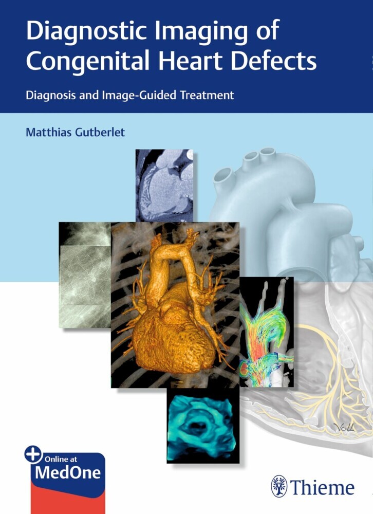 Diagnostic Imaging of Congenital Heart Defects main product photo