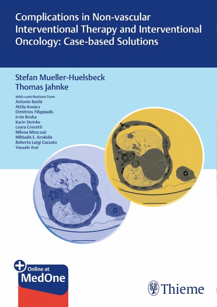 Complications in Non-vascular Interventional Therapy and Interventional Oncology: Case-based Solutions main product photo