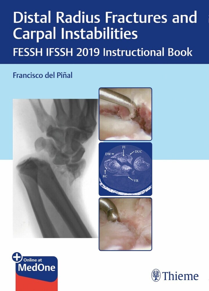 Distal Radius Fractures and Carpal Instabilities main product photo