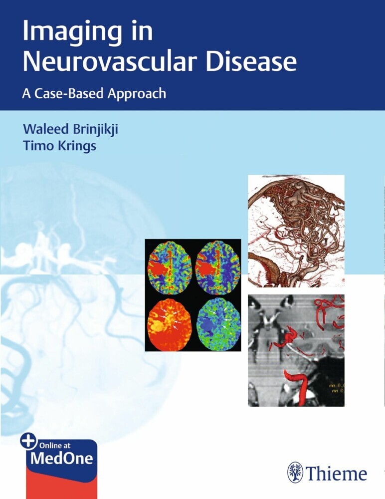 Imaging in Neurovascular Disease main product photo