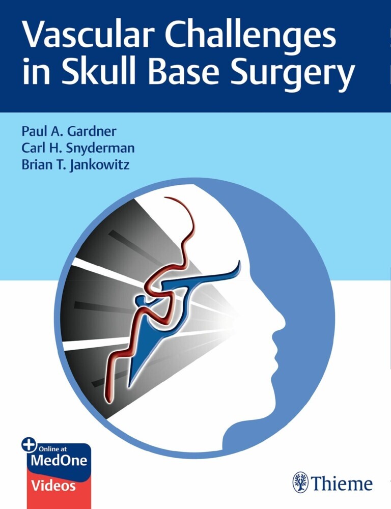 Vascular Challenges in Skull Base Surgery main product photo