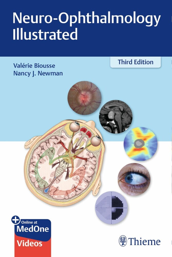 Neuro-Ophthalmology Illustrated main product photo