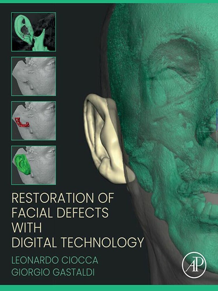 Restoration of Facial Defects with Digital Technology main product photo