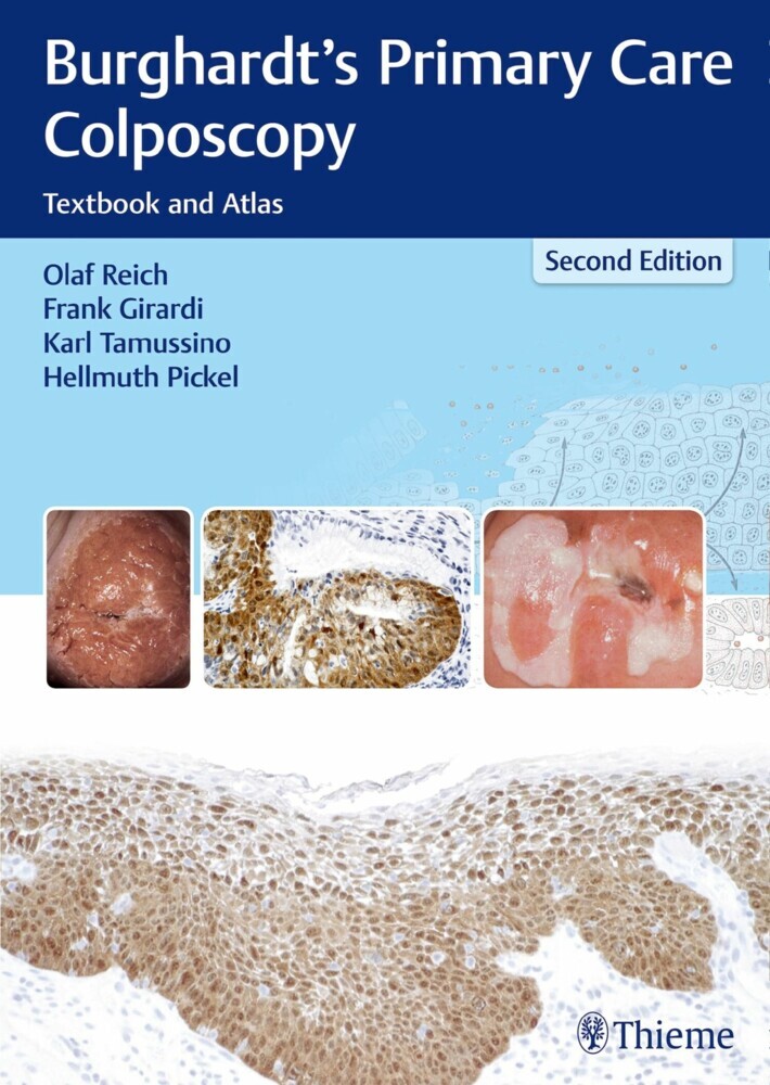 Burghardt's Primary Care Colposcopy main product photo