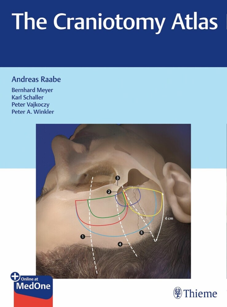 The Craniotomy Atlas main product photo