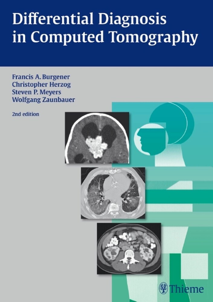 Differential Diagnosis in Computed Tomography main product photo
