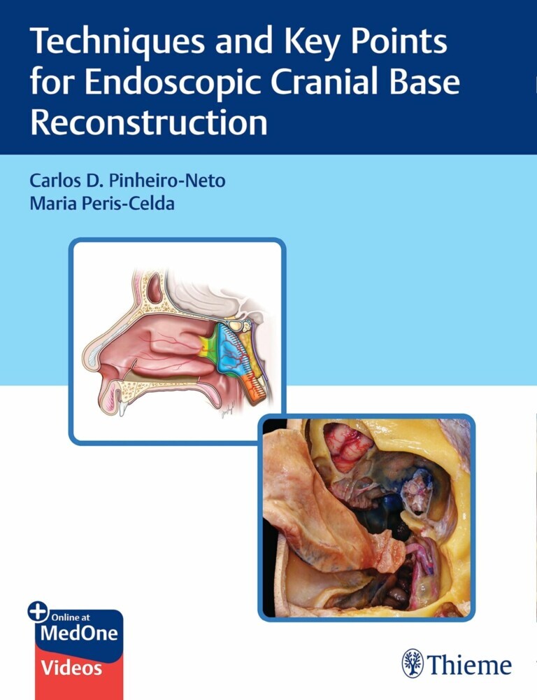 Techniques and Key Points for Endoscopic Cranial Base Reconstruction main product photo