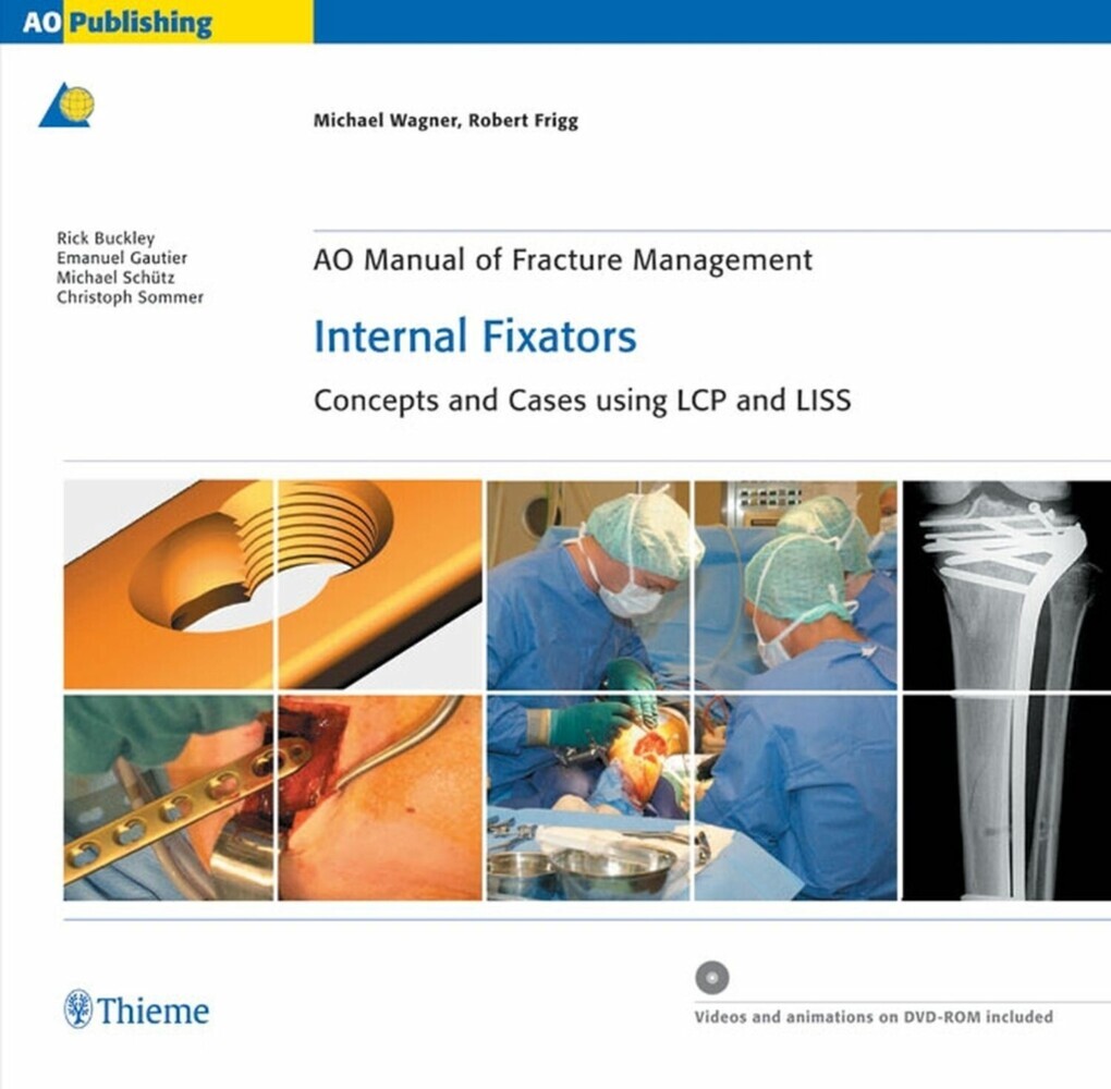 AO Manual of Fracture Management: Internal Fixators main product photo