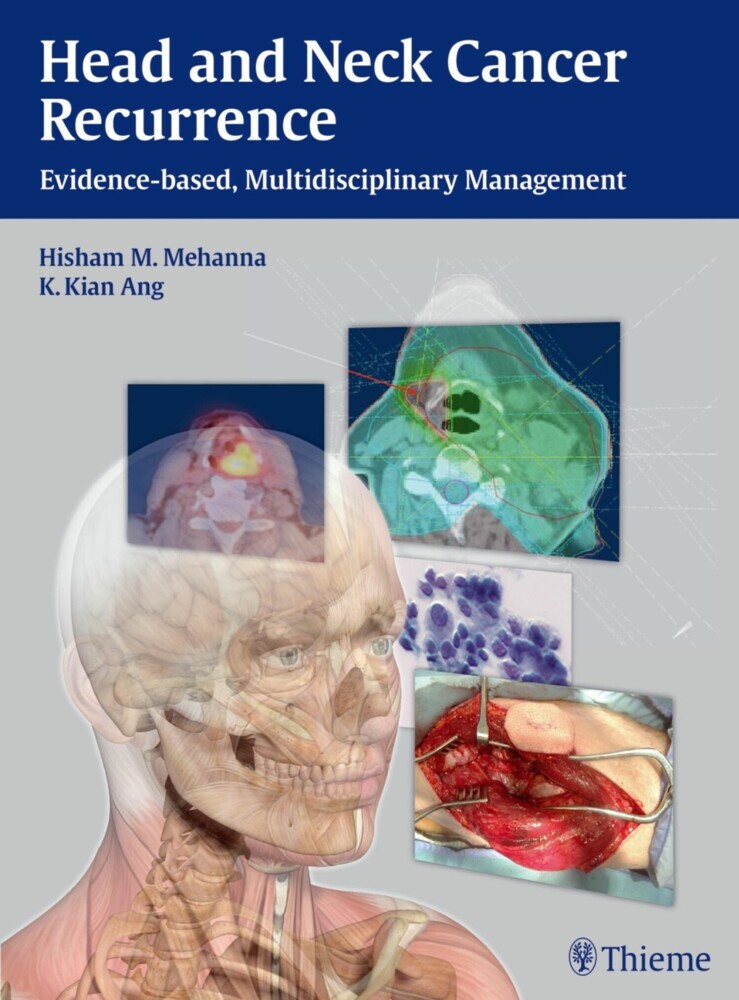 Head and Neck Cancer Recurrence main product photo