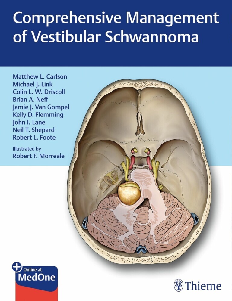Comprehensive Management of Vestibular Schwannoma main product photo